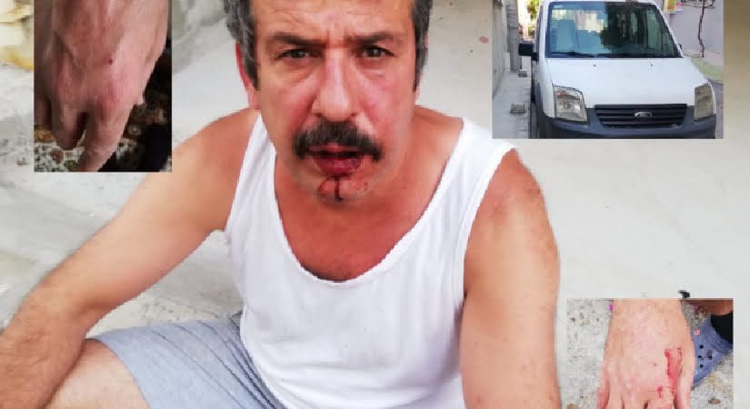 Otopark tartışması hastanelik etti